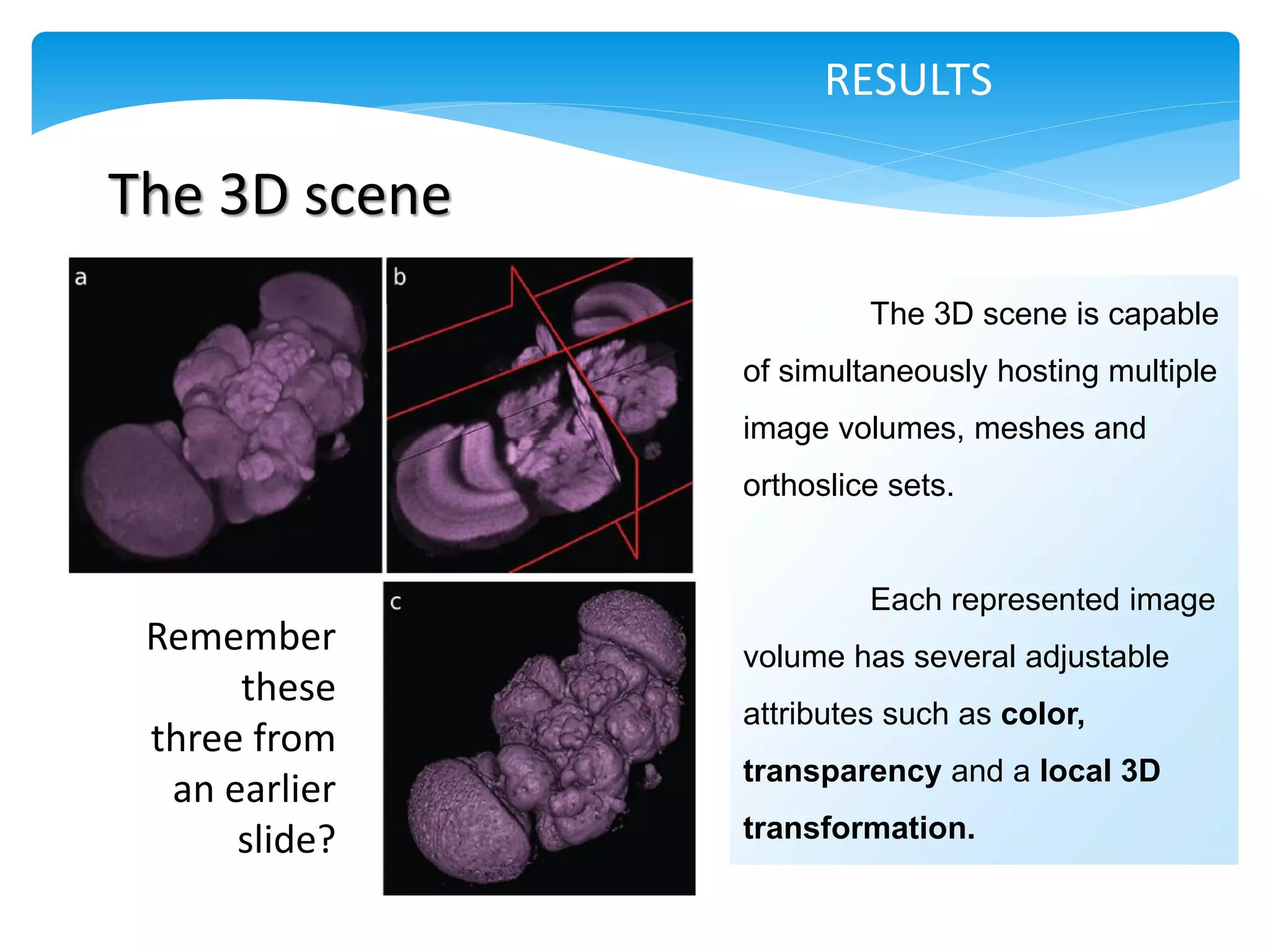 RESULTS

The 3D scene
                        The 3D scene is capable
               of simultaneously hosting multiple
               image volumes, meshes and
               orthoslice sets.


                        Each represented image
 Remember      volume has several adjustable
      these
               attributes such as color,
 three from
               transparency and a local 3D
  an earlier
      slide?   transformation.
 
