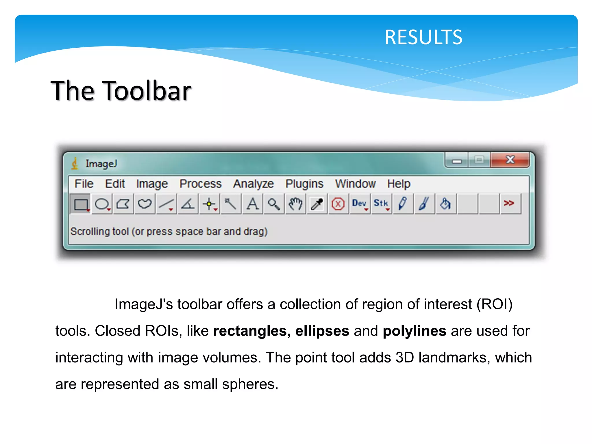 RESULTS

The Toolbar




        ImageJ's toolbar offers a collection of region of interest (ROI)
tools. Closed ROIs, like rectangles, ellipses and polylines are used for
interacting with image volumes. The point tool adds 3D landmarks, which
are represented as small spheres.
 