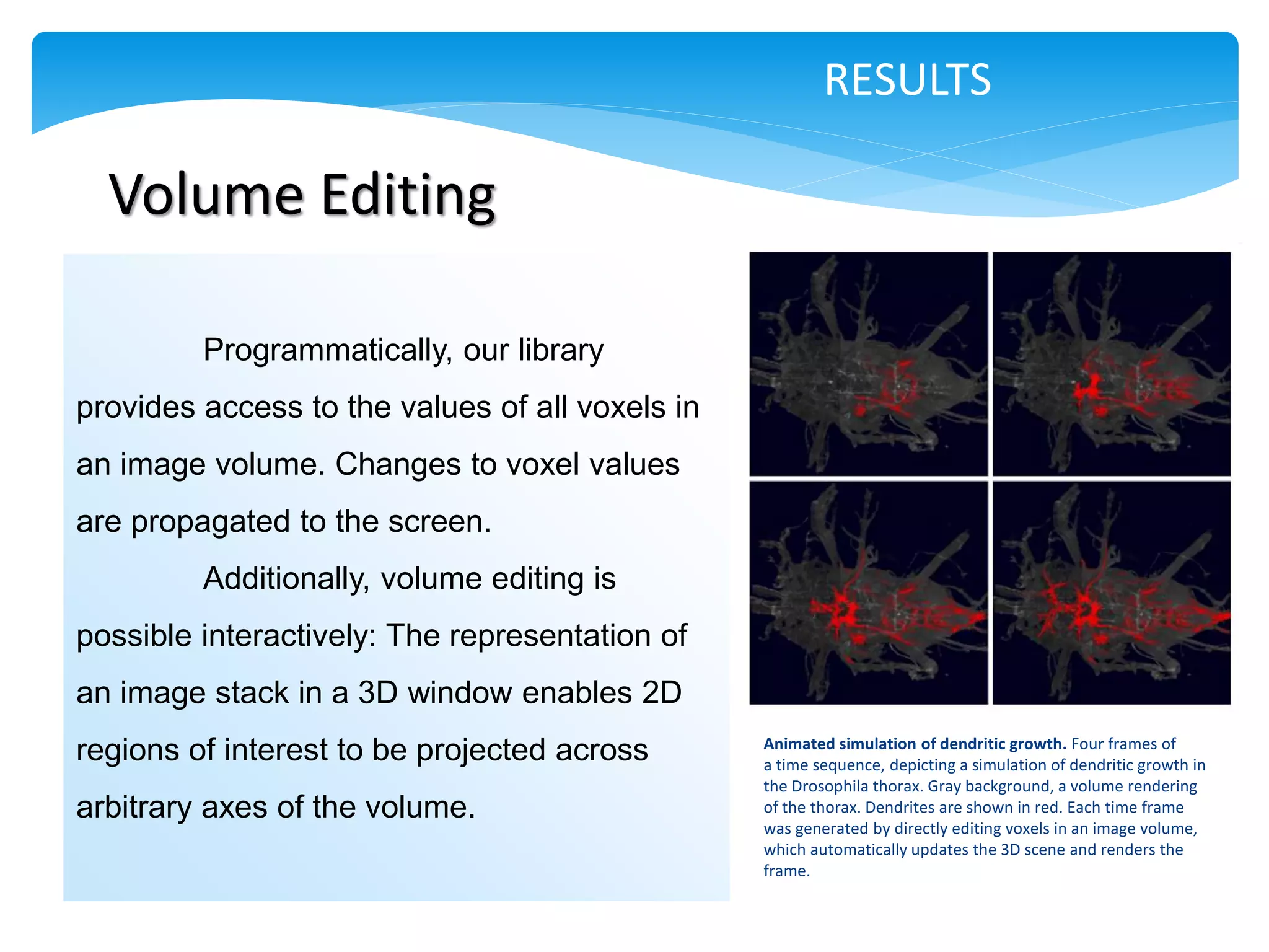 RESULTS

  Volume Editing

         Programmatically, our library
provides access to the values of all voxels in
an image volume. Changes to voxel values
are propagated to the screen.
         Additionally, volume editing is
possible interactively: The representation of
an image stack in a 3D window enables 2D
                                                 Animated simulation of dendritic growth. Four frames of
regions of interest to be projected across       a time sequence, depicting a simulation of dendritic growth in
                                                 the Drosophila thorax. Gray background, a volume rendering
arbitrary axes of the volume.                    of the thorax. Dendrites are shown in red. Each time frame
                                                 was generated by directly editing voxels in an image volume,
                                                 which automatically updates the 3D scene and renders the
                                                 frame.
 