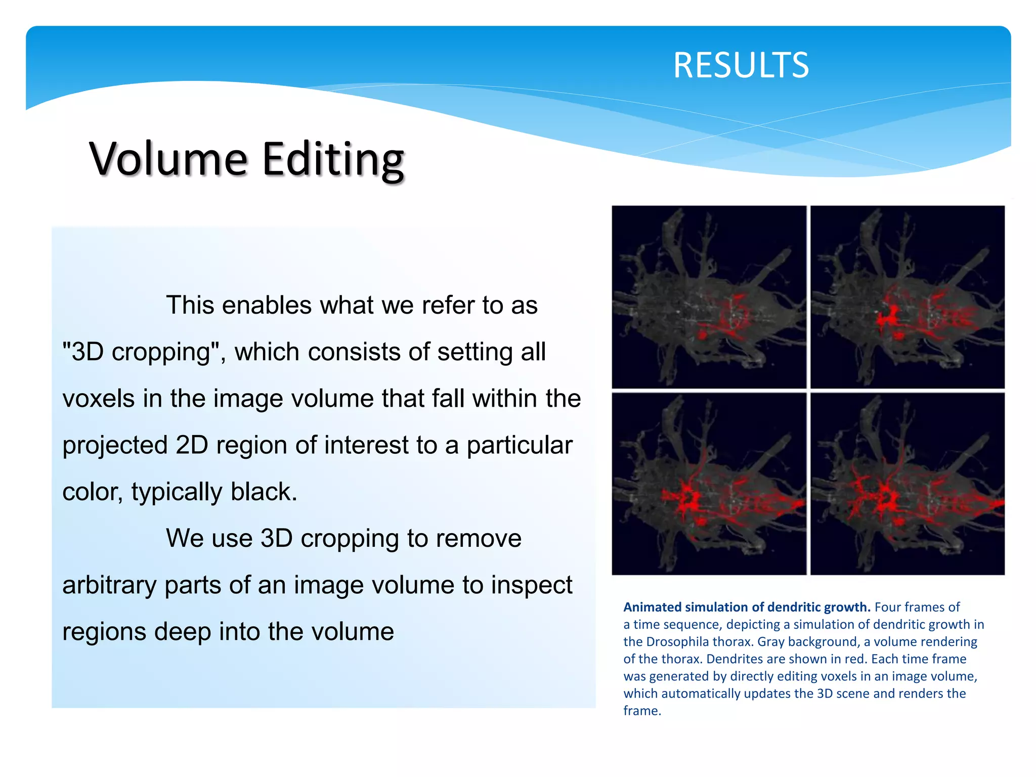RESULTS

  Volume Editing

          This enables what we refer to as
"3D cropping", which consists of setting all
voxels in the image volume that fall within the
projected 2D region of interest to a particular
color, typically black.
          We use 3D cropping to remove
arbitrary parts of an image volume to inspect
                                                  Animated simulation of dendritic growth. Four frames of
                                                  a time sequence, depicting a simulation of dendritic growth in
regions deep into the volume                      the Drosophila thorax. Gray background, a volume rendering
                                                  of the thorax. Dendrites are shown in red. Each time frame
                                                  was generated by directly editing voxels in an image volume,
                                                  which automatically updates the 3D scene and renders the
                                                  frame.
 