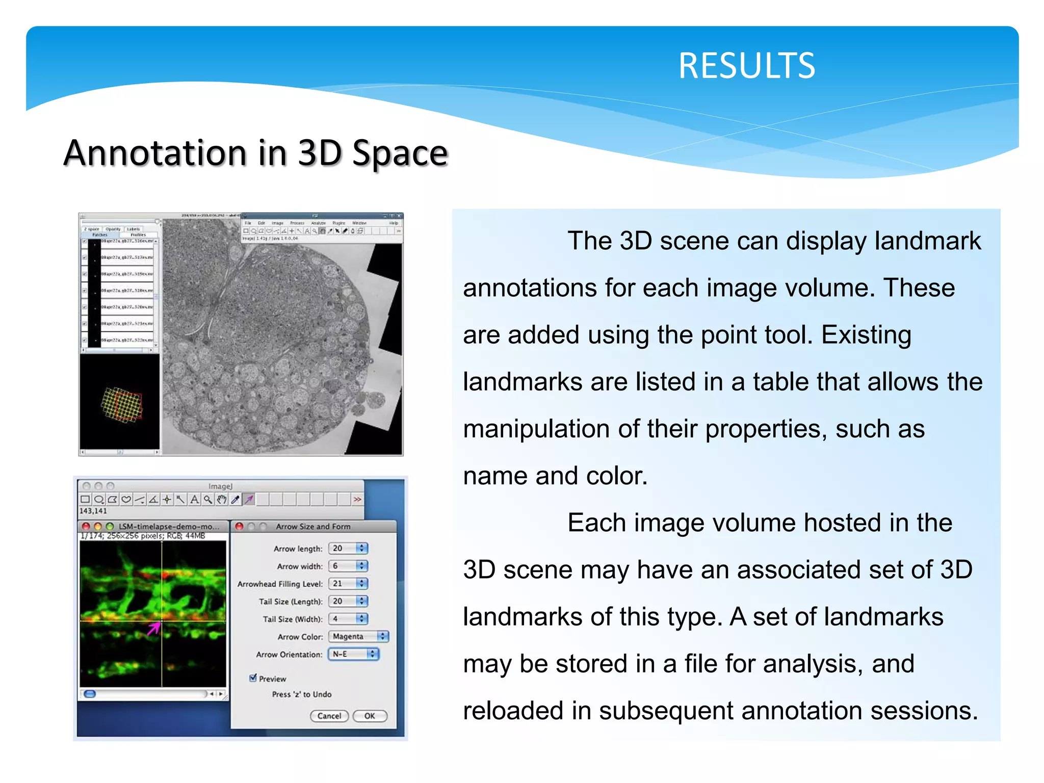 RESULTS

Annotation in 3D Space

                                  The 3D scene can display landmark
                         annotations for each image volume. These
                         are added using the point tool. Existing
                         landmarks are listed in a table that allows the
                         manipulation of their properties, such as
                         name and color.
                                  Each image volume hosted in the
                         3D scene may have an associated set of 3D
                         landmarks of this type. A set of landmarks
                         may be stored in a file for analysis, and
                         reloaded in subsequent annotation sessions.
 