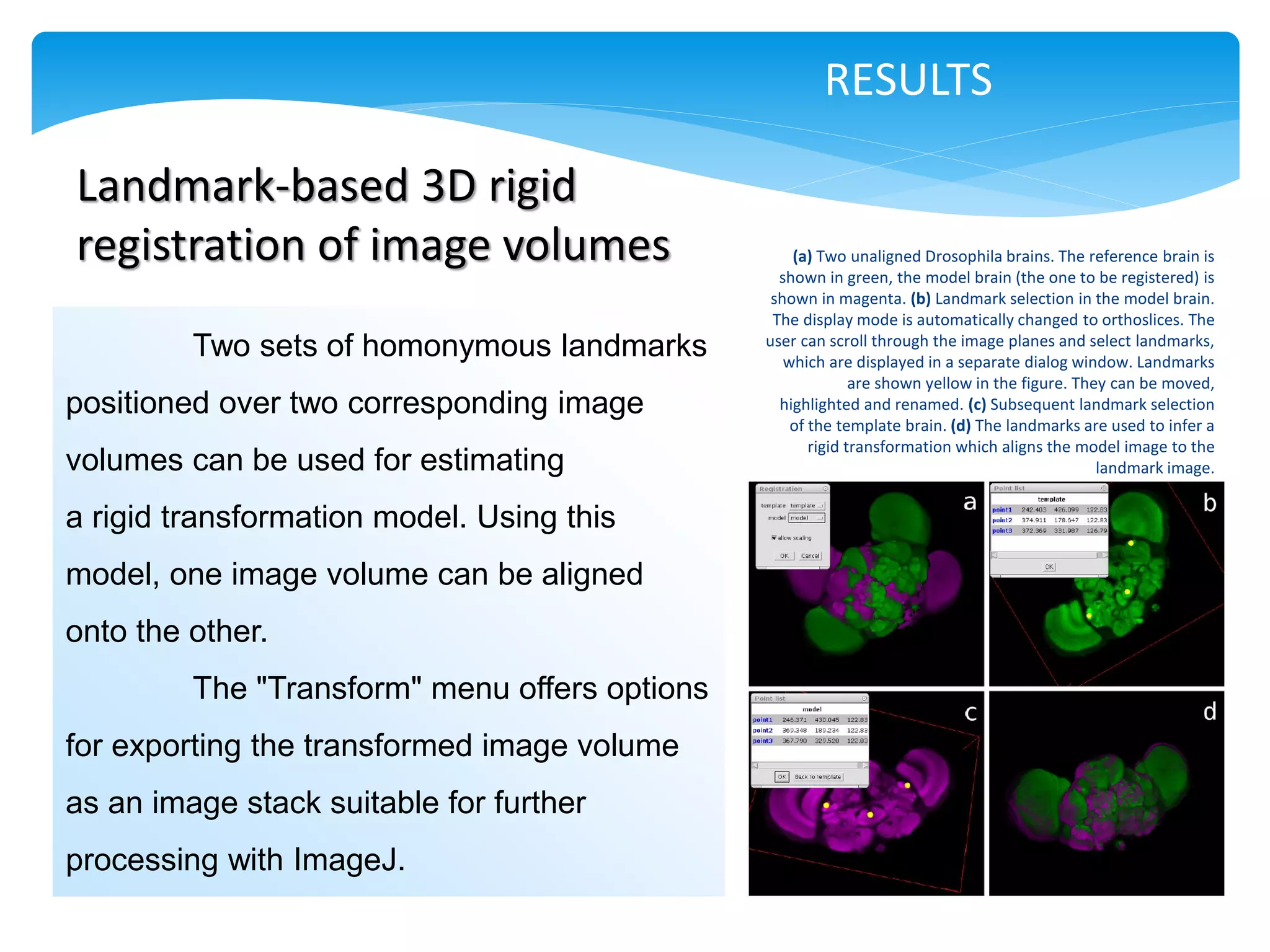RESULTS

Landmark-based 3D rigid
registration of image volumes                      (a) Two unaligned Drosophila brains. The reference brain is
                                                 shown in green, the model brain (the one to be registered) is
                                                shown in magenta. (b) Landmark selection in the model brain.
                                                The display mode is automatically changed to orthoslices. The
                                               user can scroll through the image planes and select landmarks,
         Two sets of homonymous landmarks         which are displayed in a separate dialog window. Landmarks
                                                             are shown yellow in the figure. They can be moved,
positioned over two corresponding image          highlighted and renamed. (c) Subsequent landmark selection
                                                   of the template brain. (d) The landmarks are used to infer a
                                                      rigid transformation which aligns the model image to the
volumes can be used for estimating                                                              landmark image.


a rigid transformation model. Using this
model, one image volume can be aligned
onto the other.
         The "Transform" menu offers options
for exporting the transformed image volume
as an image stack suitable for further
processing with ImageJ.
 