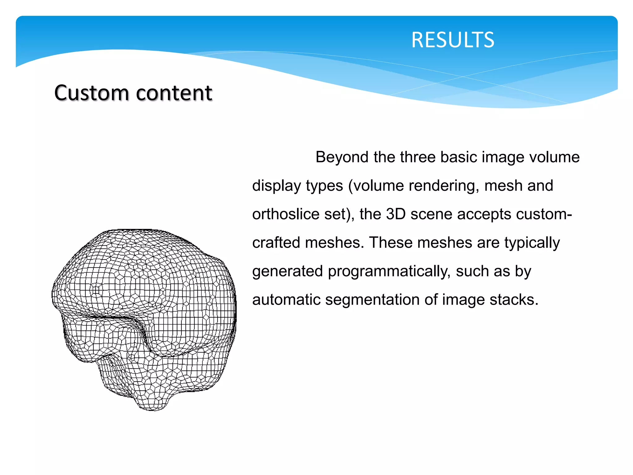 RESULTS

Custom content

                         Beyond the three basic image volume
                 display types (volume rendering, mesh and
                 orthoslice set), the 3D scene accepts custom-
                 crafted meshes. These meshes are typically
                 generated programmatically, such as by
                 automatic segmentation of image stacks.
 