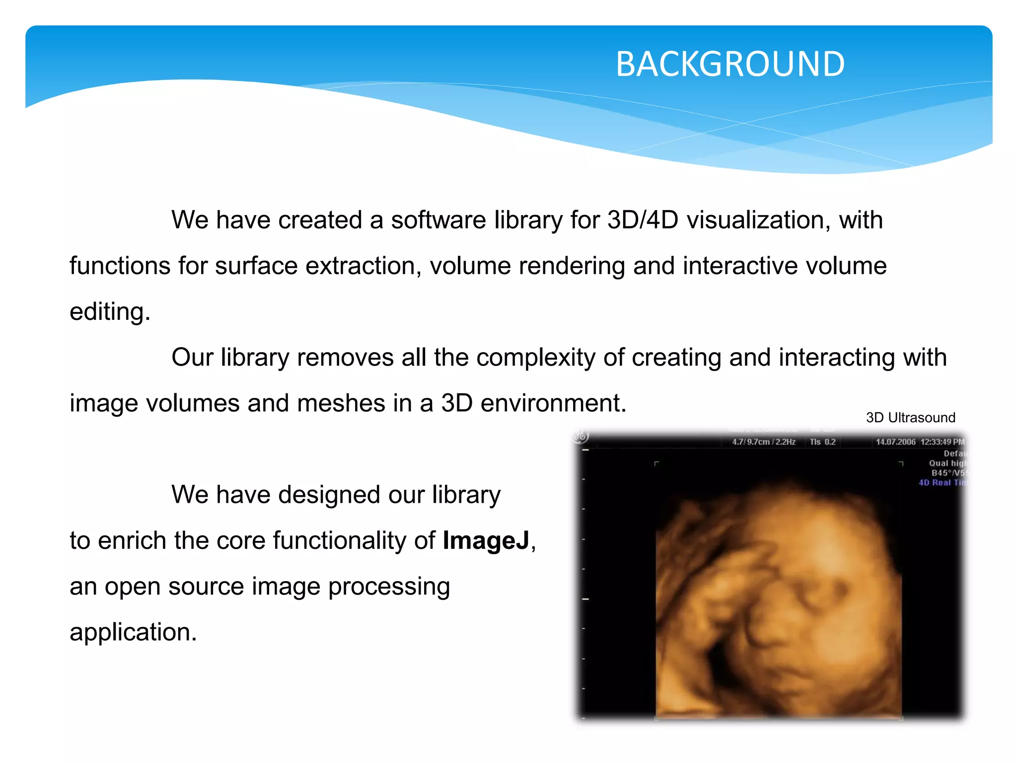 BACKGROUND


           We have created a software library for 3D/4D visualization, with
functions for surface extraction, volume rendering and interactive volume
editing.
           Our library removes all the complexity of creating and interacting with
image volumes and meshes in a 3D environment.                             3D Ultrasound




           We have designed our library
to enrich the core functionality of ImageJ,
an open source image processing
application.
 