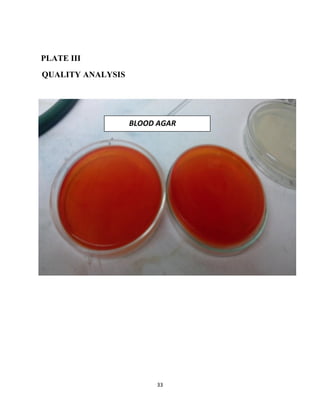 33
PLATE III
QUALITY ANALYSIS
BLOOD AGAR
 