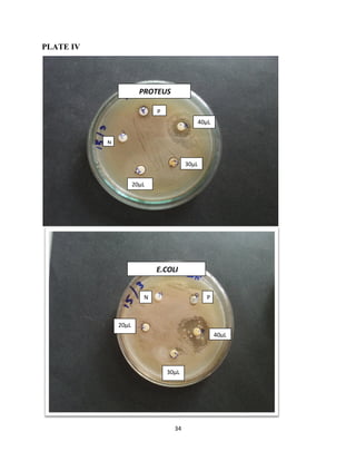 34
PLATE IV
40µL
PROTEUS
40µL
30µL
20µL
N
P
E.COLI
P
30µL
20µL
N
 