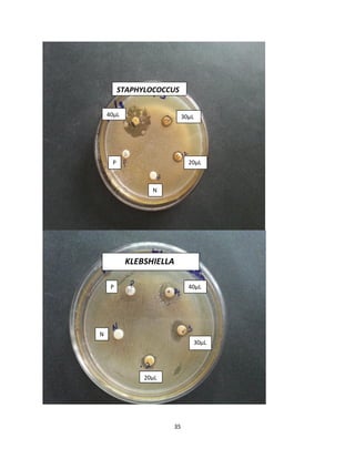 35
40µL 30µL
20µL
N
P
STAPHYLOCOCCUS
P
KLEBSHIELLA
40µL
30µL
20µL
N
 