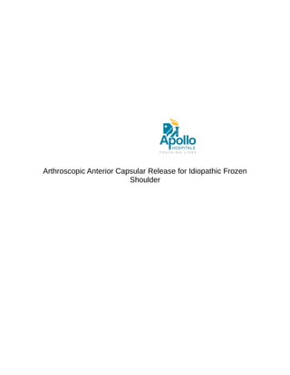 Arthroscopic Anterior Capsular Release for Idiopathic Frozen
Shoulder
 