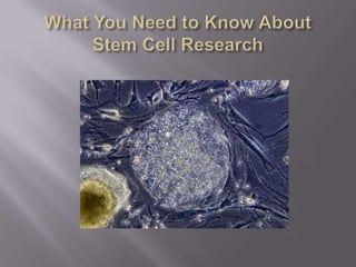 What You Need to Know About Stem Cell Research 