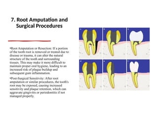 final perio.pptx presentation periodontal | PPTX