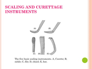 SCALING AND CURETTAGE
INSTRUMENTS
The five basic scaling instruments. A, Curette; B,
sickle; C, file; D, chisel; E, hoe.
 
