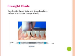 Straight Blade
Excellent for broad facial and lingual surfaces
and can also be used interproximally.
 