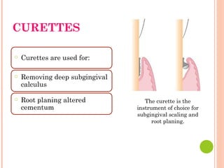 CURETTES
○ Curettes are used for:
○ Removing deep subgingival
calculus
○ Root planing altered
cementum
The curette is the
instrument of choice for
subgingival scaling and
root planing.
 