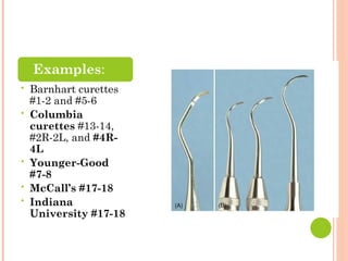 ○ Examples:
• Barnhart curettes
#1-2 and #5-6
• Columbia
curettes #13-14,
#2R-2L, and #4R-
4L
• Younger-Good
#7-8
• McCall’s #17-18
• Indiana
University #17-18
 
