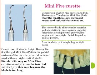 Comparison of After Five curette and Mini
Five curette. The shorter Mini Five blade
(half the length) allows increased
access and reduced tissue trauma.
The shorter blade allows easier insertion
and adaptation in deep, narrow pockets;
furcations; developmental grooves; line
angles; and deep, tight, facial, lingual, or
palatal pockets.’
Area in which root morphology or tight
tissue
Comparison of standard rigid Gracey #5-
6 with rigid Mini Five #5-6 on the palatal
surfaces of the maxillary central incisors.
used with a straight vertical stroke.
Standard Gracey or After Five
curette usually cannot be inserted
vertically in this area because the
blade is too long.
Mini Five curette
 