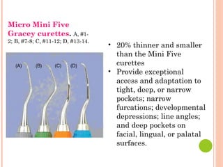 Micro Mini Five
Gracey curettes. A, #1-
2; B, #7-8; C, #11-12; D, #13-14.
• 20% thinner and smaller
than the Mini Five
curettes
• Provide exceptional
access and adaptation to
tight, deep, or narrow
pockets; narrow
furcations; developmental
depressions; line angles;
and deep pockets on
facial, lingual, or palatal
surfaces.
 
