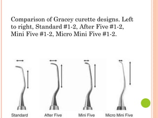 Comparison of Gracey curette designs. Left
to right, Standard #1-2, After Five #1-2,
Mini Five #1-2, Micro Mini Five #1-2.
 