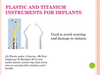 PLASTIC AND TITANIUM
INSTRUMENTS FOR IMPLANTS
(A) Plastic probe: Colorvue. (B) New
Implacare II Barnhart #5-6 cone
socket plastic curette tips that screw
into an autoclavable stainless steel
handle.
Used to avoid scarring
and damage to imlants
 