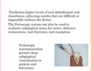 ○ Facilitates higher levels of root debridement and
cleanliness, achieving results that are difficult or
impossible without the device.
○ The Perioscopy system can also be used to
evaluate subgingival areas for caries, defective
restorations, root fractures, and resorption
Perioscopic
instrumentation
permits deep
subgingival
visualization in
pockets and
furcations.
 