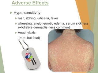 Adverse Effects
 Hypersensitivity-
 rash, itching, urticaria, fever
 wheezing, angioneurotic edema, serum sickness,
exfoliative dermatitis (less common)
 Anaphylaxis
(rare, but fatal)
21
 