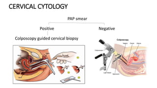 Post Menopausal Bleeding (gynaecology) - Evaluation