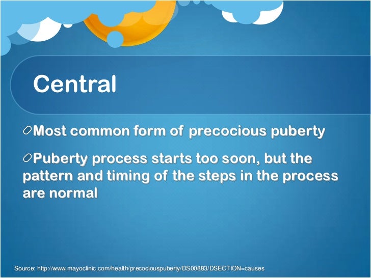 precocious-puberty