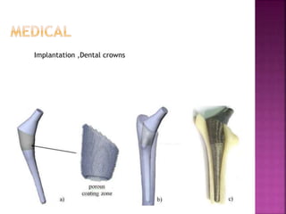 Implantation ,Dental crowns
 