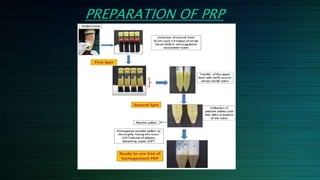 platelet concentrates in dentistry | PPTX