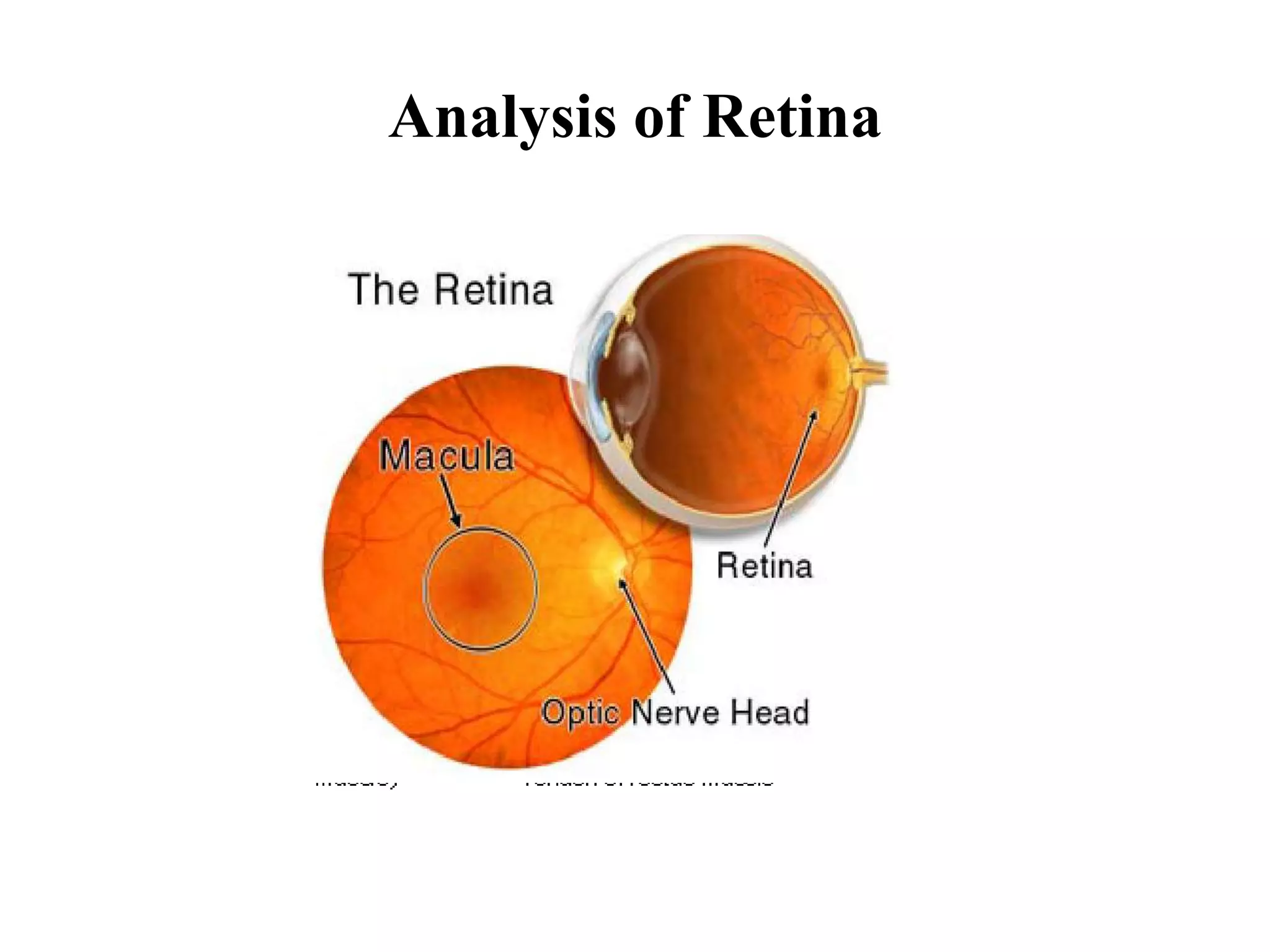 Analysis of Retina
 