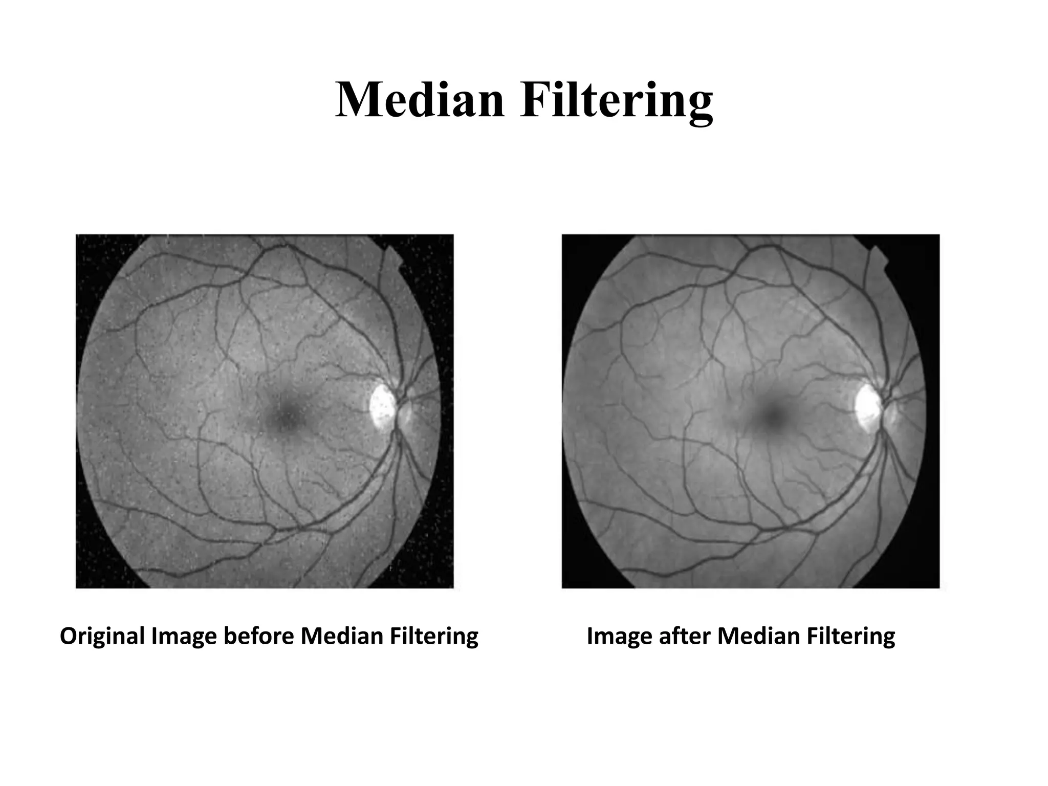 Median Filtering
Original Image before Median Filtering Image after Median Filtering
 
