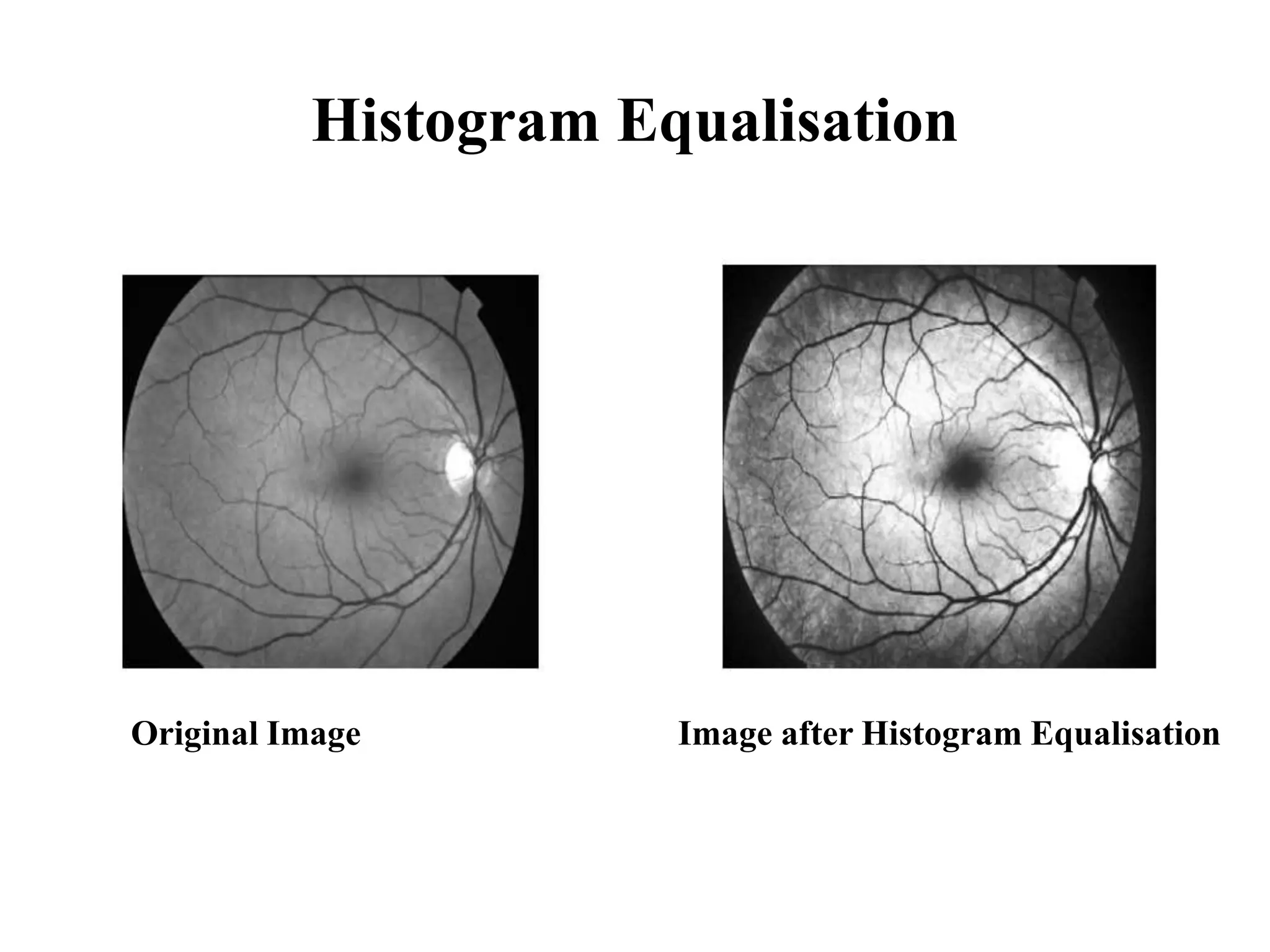 Histogram Equalisation
Original Image Image after Histogram Equalisation
 