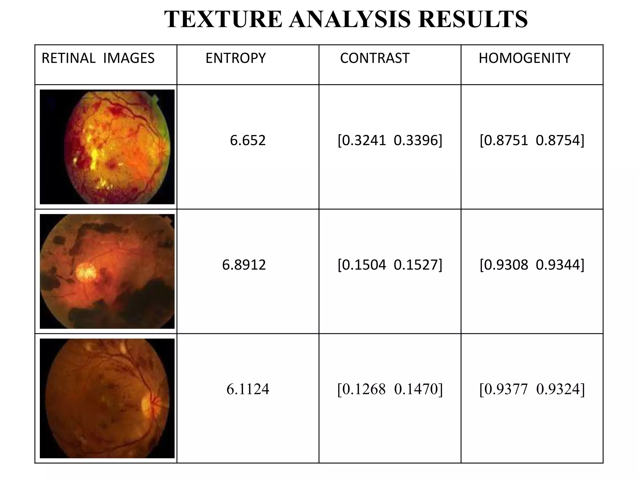 RETINAL IMAGES ENTROPY CONTRAST HOMOGENITY
6.652 [0.3241 0.3396] [0.8751 0.8754]
6.8912 [0.1504 0.1527] [0.9308 0.9344]
6.1124 [0.1268 0.1470] [0.9377 0.9324]
TEXTURE ANALYSIS RESULTS
 