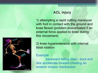 Acl External Rotation Knee Injuries In Detail | PPT