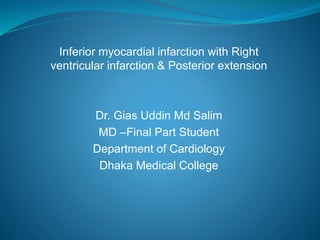 Inferior myocardial infarction with Right
ventricular infarction & Posterior extension
Dr. Gias Uddin Md Salim
MD –Final Part Student
Department of Cardiology
Dhaka Medical College
 