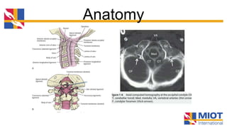 Injuries at occipitocervical junction | PPTX
