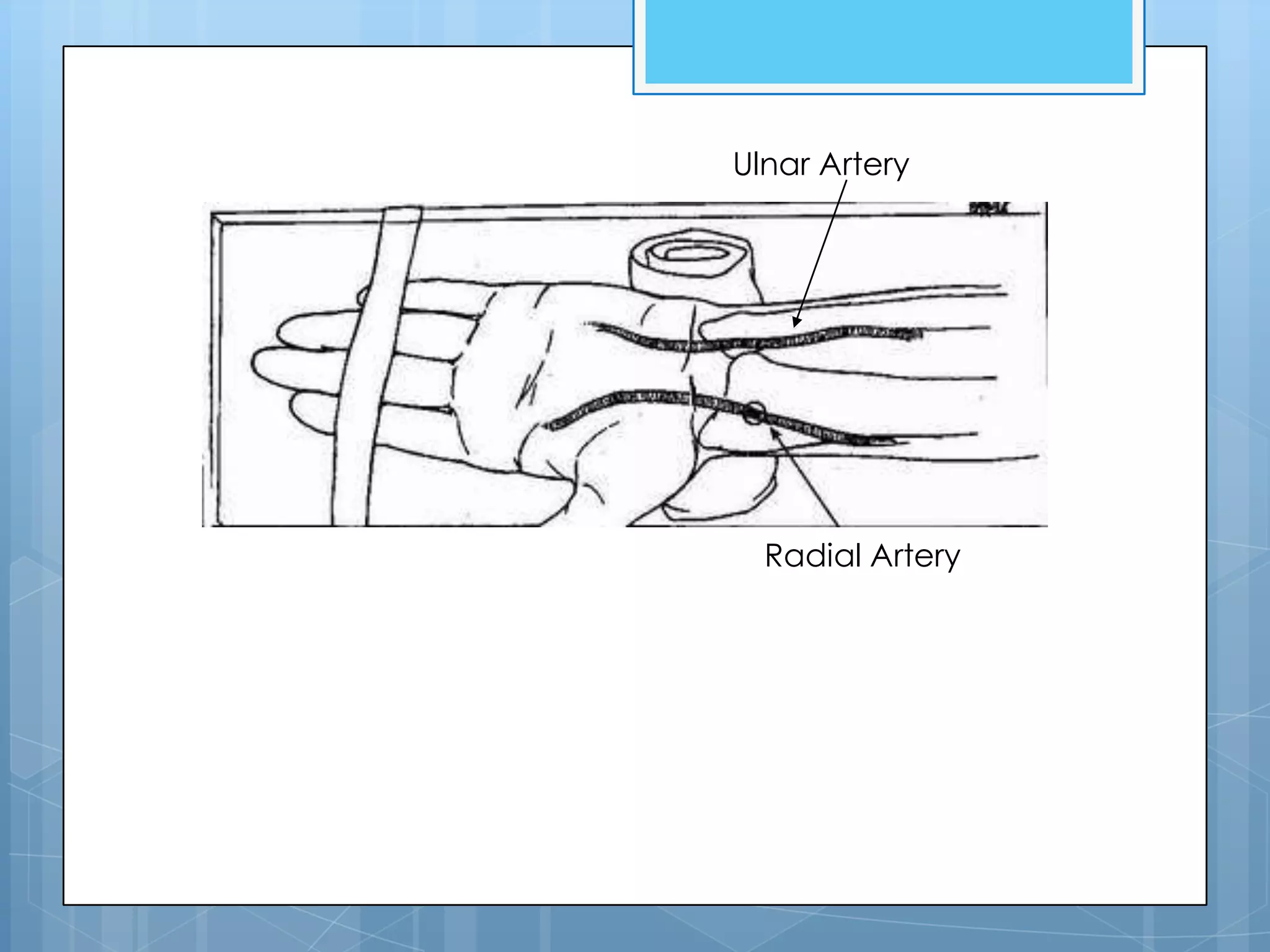 Ulnar Artery




  Radial Artery
 