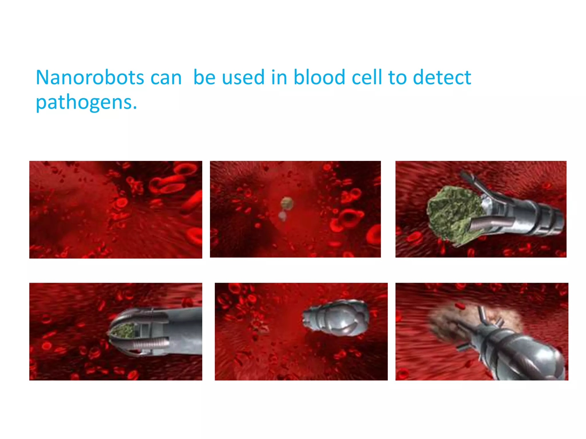 Nanorobots can be used in blood cell to detect
pathogens.
 