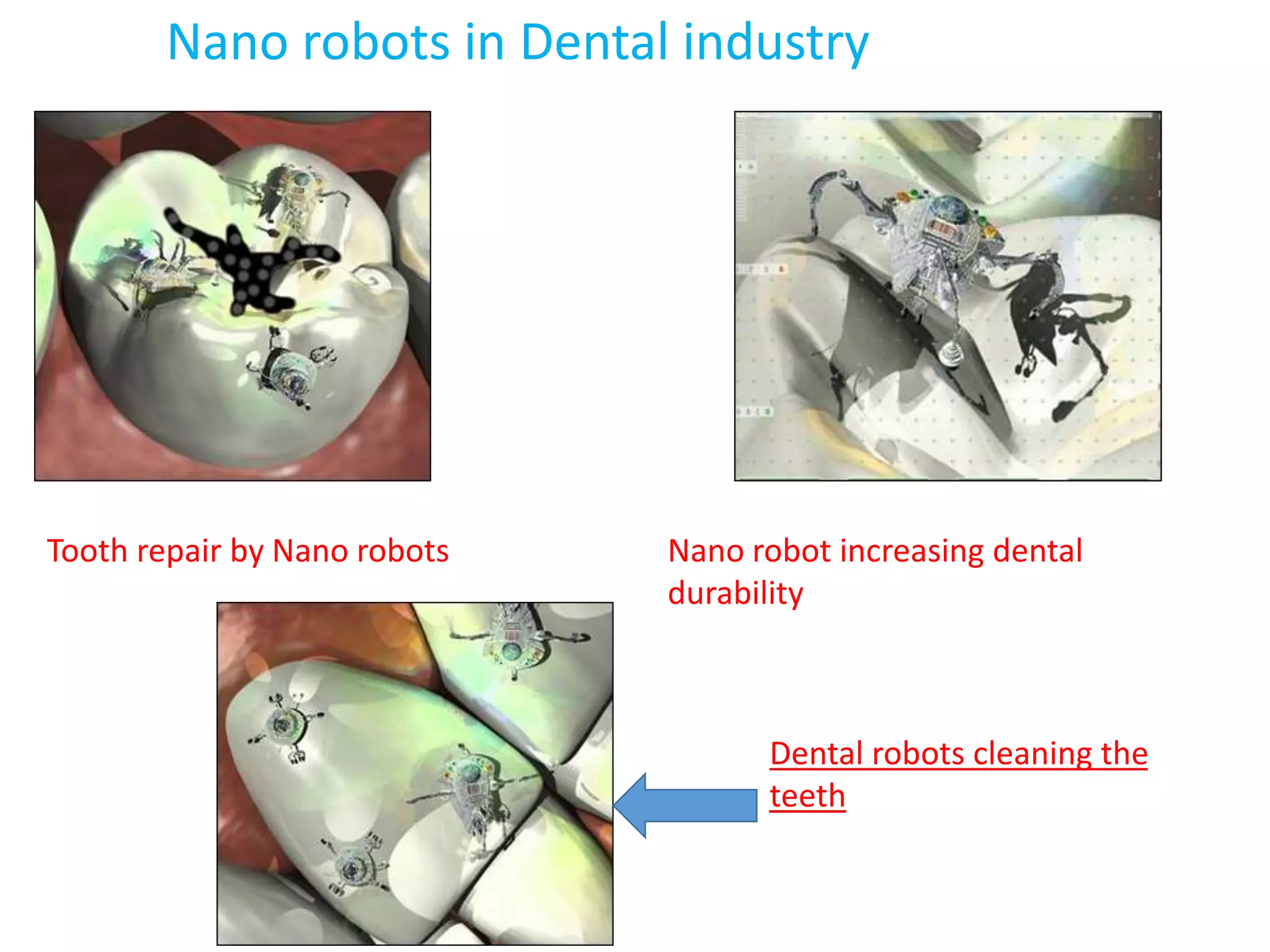 Nano robots in Dental industry
Tooth repair by Nano robots Nano robot increasing dental
durability
Dental robots cleaning the
teeth
 