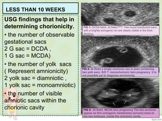 Acnormal Usg Week ROLE OF ULTRASOUND IN MULTIFETAL GESTATION - WHAT AN OBSTETRICIAN ...