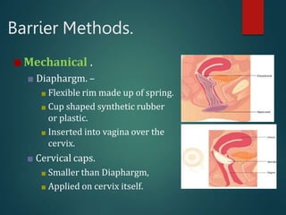 final PPT contraceptive methods28.5.21.pptx