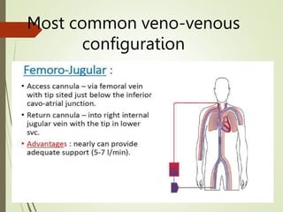 Most common veno-venous
configuration
 