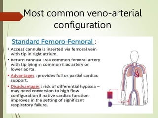 Most common veno-arterial
configuration
 