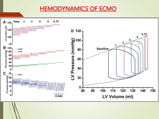 HEMODYNAMICS OF ECMO
 