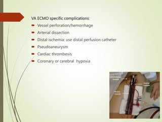 VA ECMO specific complications:
 Vessel perforation/hemorrhage
 Arterial dissection
 Distal ischemia: use distal perfusion catheter
 Pseudoaneurysm
 Cardiac thrombosis
 Coronary or cerebral hypoxia
 