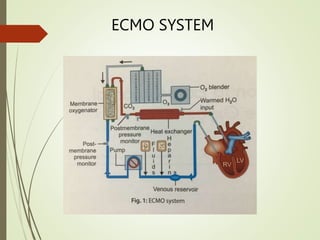ECMO SYSTEM
 