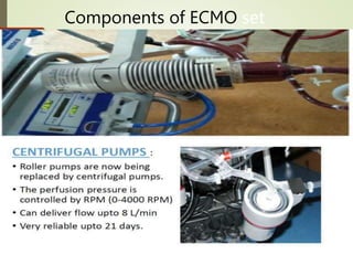 Components of ECMO set
up
 