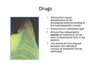 Drugs
• Tetracycline causes
discoloration of the
developing teeth by binding to
the hydroxyapatite crystals
• Fluorescent in ultraviolet light
• At least five independent
courses of treatment can be
seen as fluorescent lines in the
dentine
• the period of time elapsed
between the individual
courses of treatment can be
estimated
 