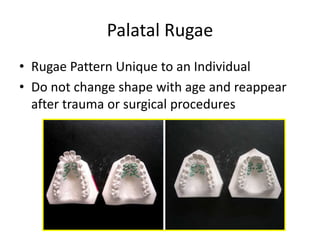 Palatal Rugae
• Rugae Pattern Unique to an Individual
• Do not change shape with age and reappear
after trauma or surgical procedures
 