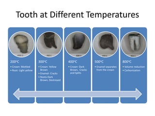 Tooth at Different Temperatures
200oC
• Crown- Mottled
• Root- Light yellow
300oC
• Crown- Yellow
Brown
• Enamel- Cracks
• Roots-Dark
Brown, Destroyed
400oC
• Crown- Dark
Brown, Cracks
and Splits
500oC
• Enamel separates
from the crown
800oC
• Volume reduction
• Carbonization
 