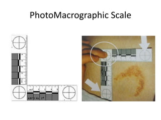 PhotoMacrographic Scale
 